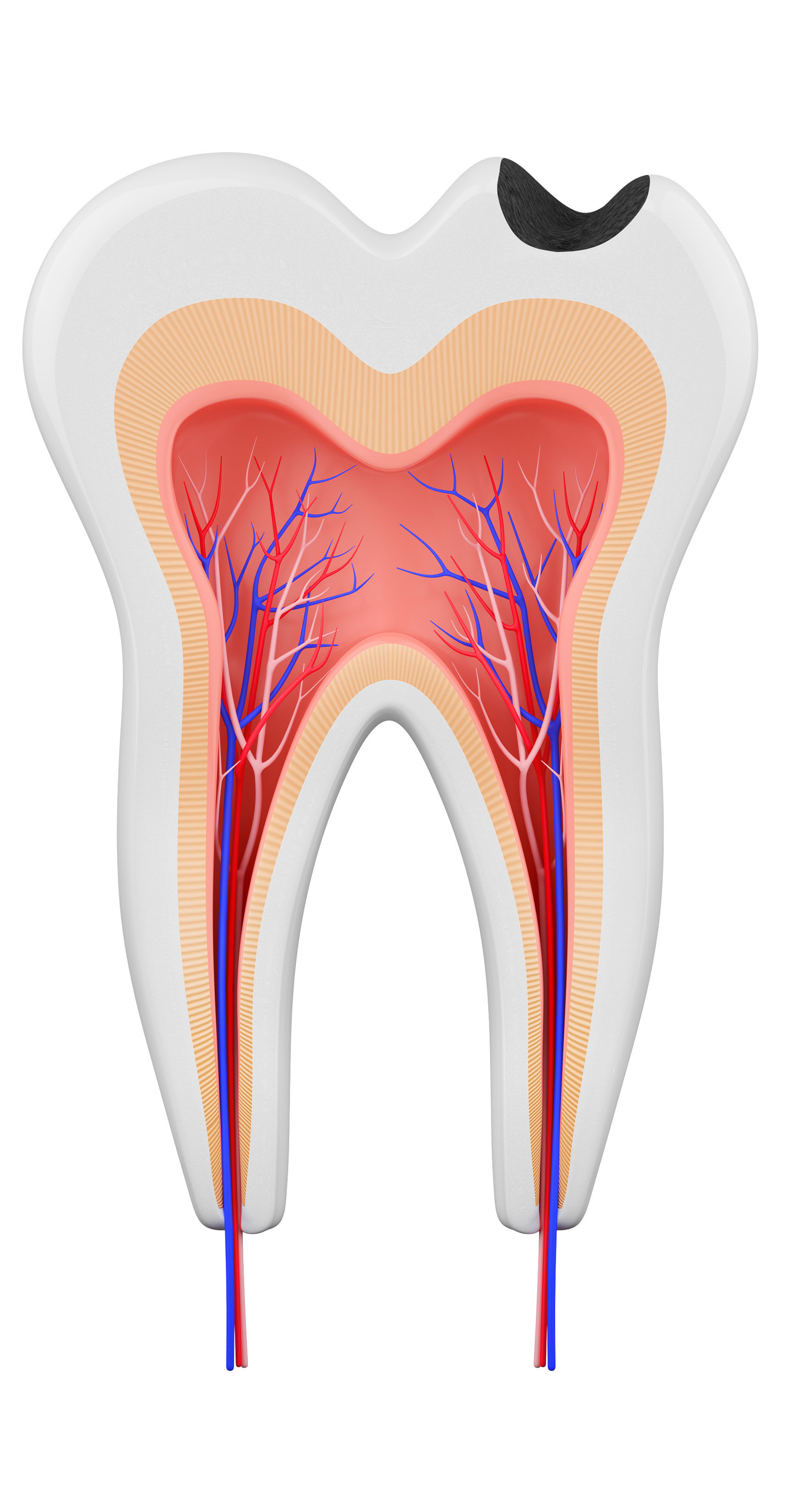 Tooth Image 2