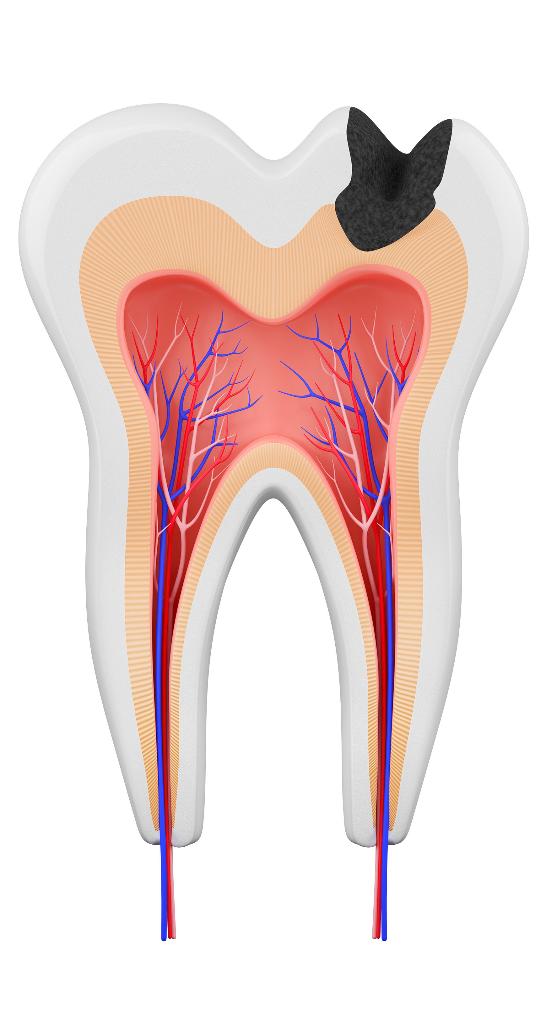 Tooth Image 3