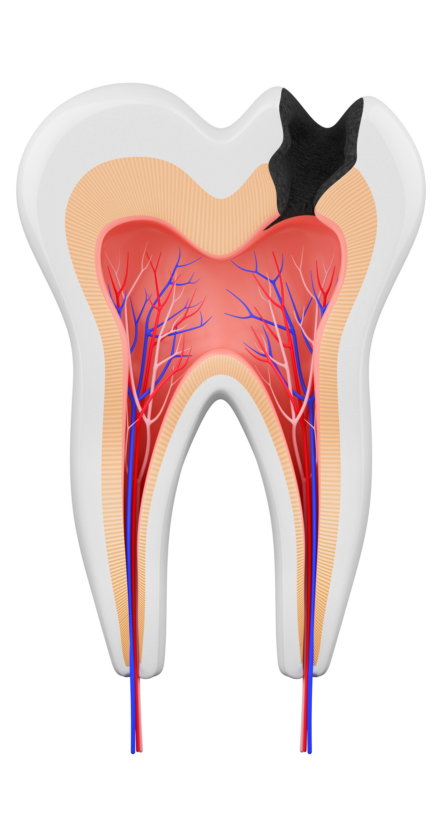 Tooth Image 4