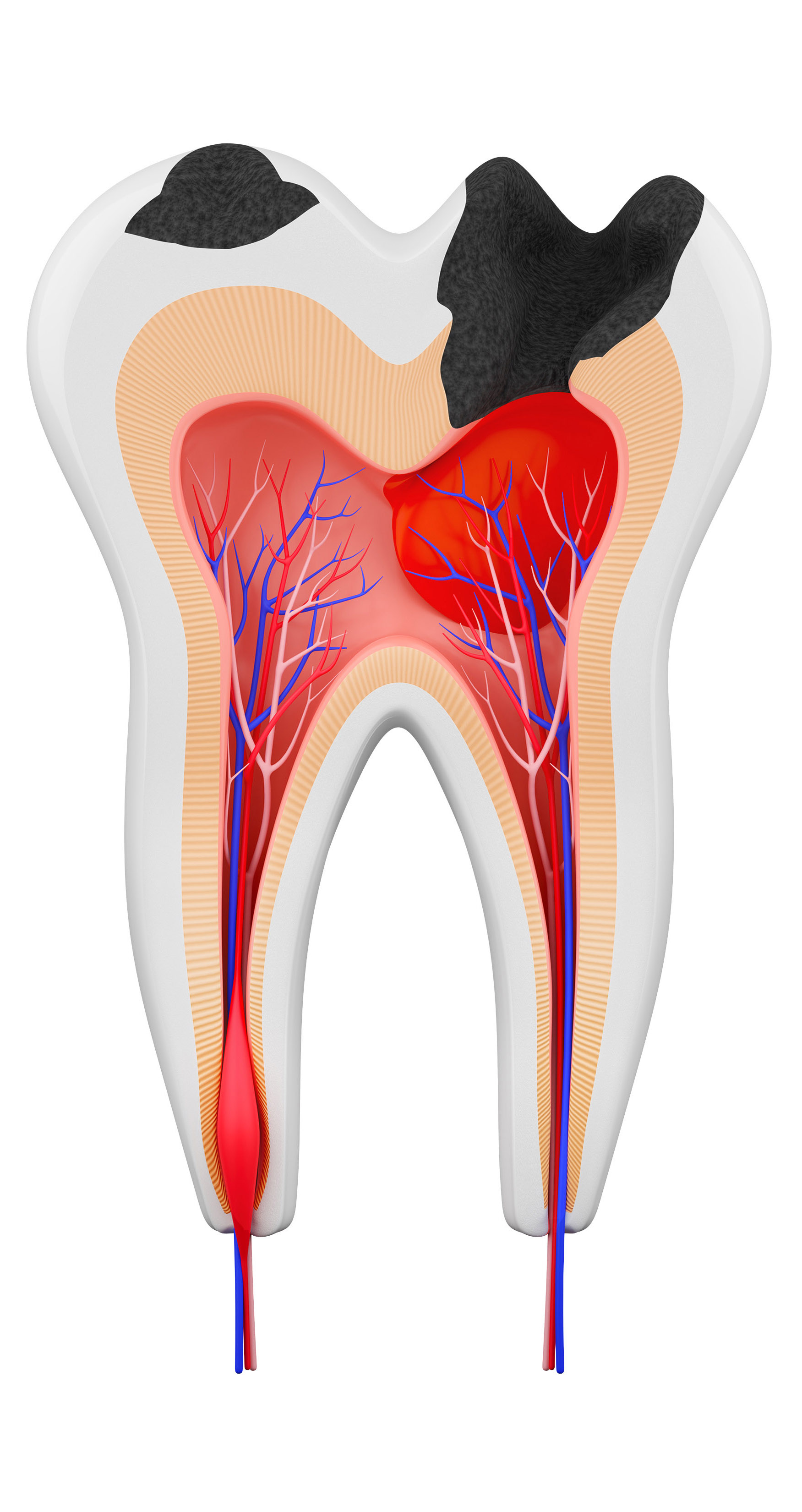Tooth Image 5